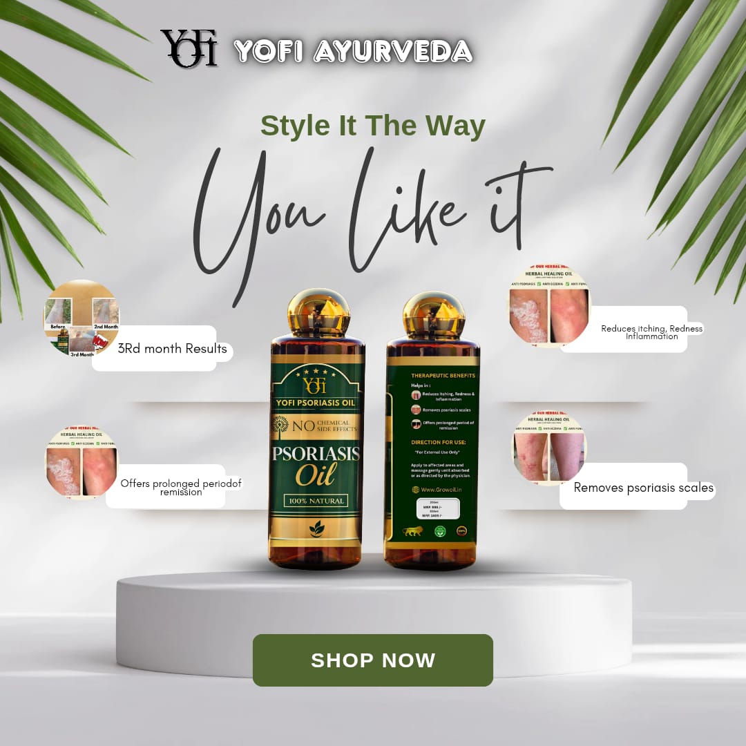 YUFI Herbal Psoriasis -Clearing Oil